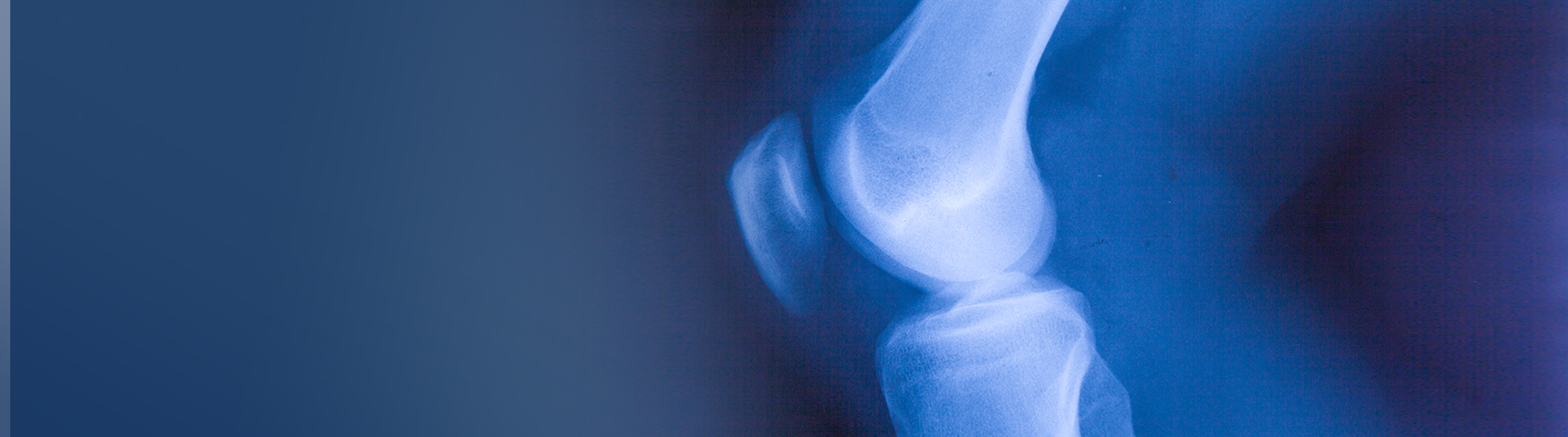 Sports recovery and hyperbaric oxygen therapy HybO2